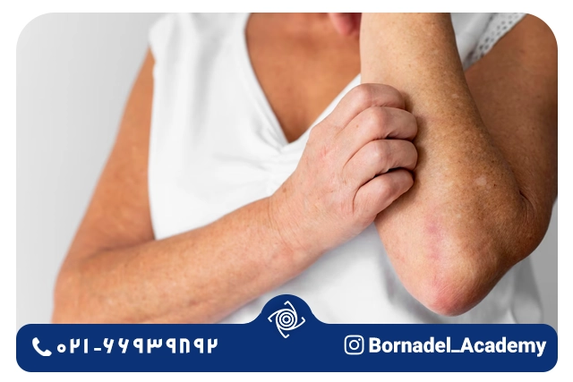 پایش و ارزیابی مداوم
